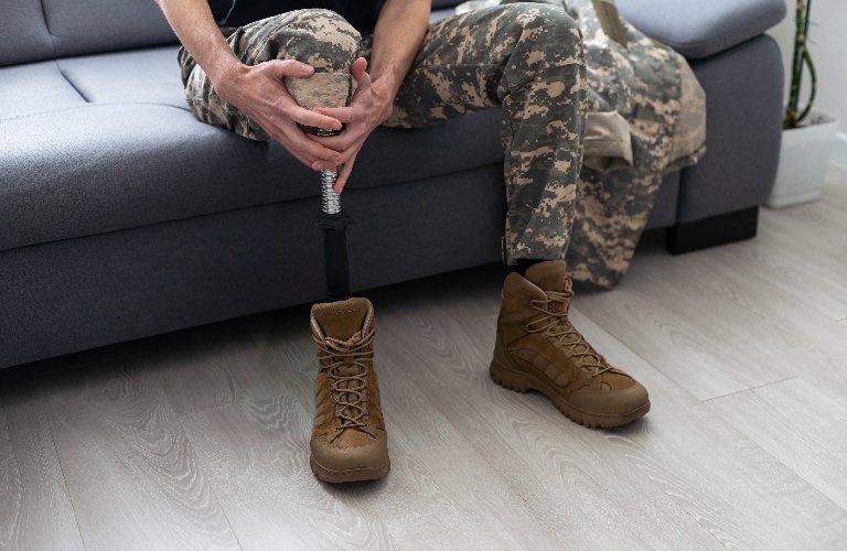 veteran with artificial prosthetic leg