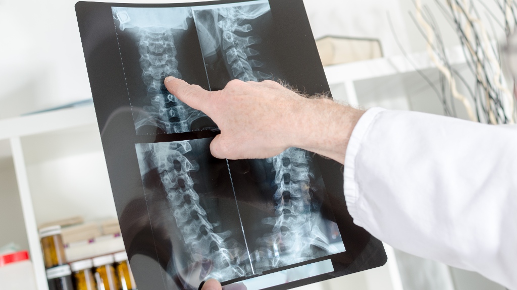 Doctor showing a detail on a x-ray radiography in medical office
