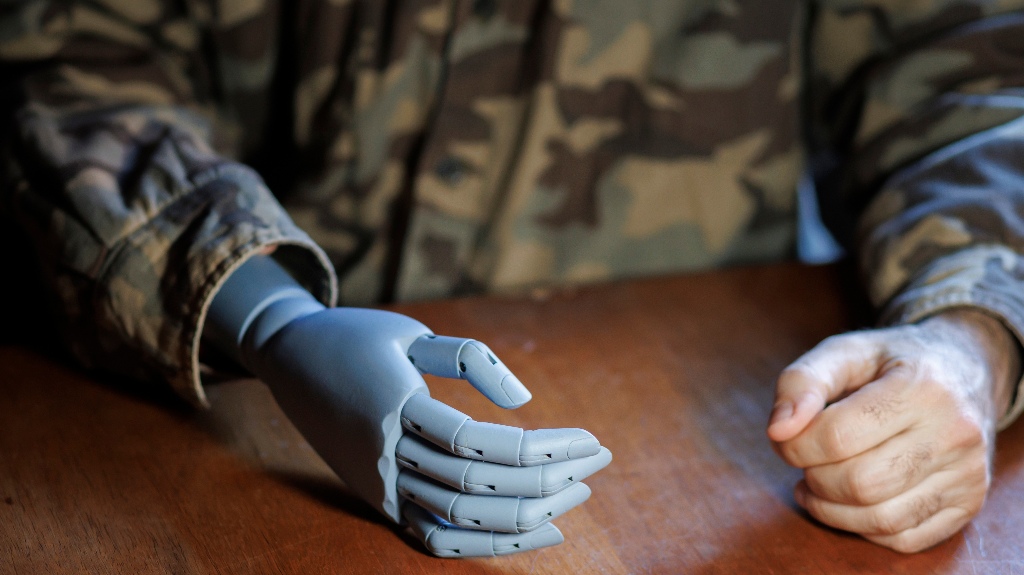 Veteran with a prosthetic arm